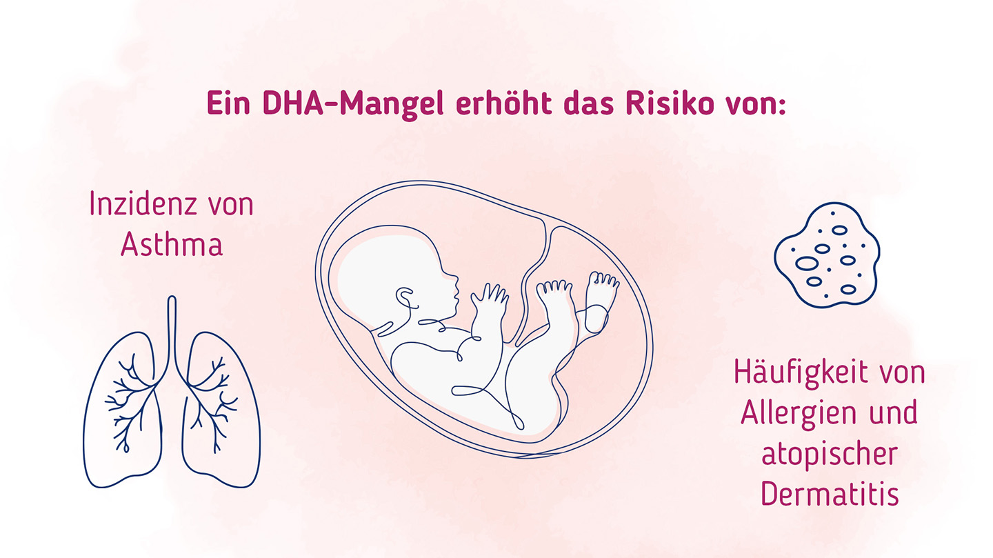Ein DHA-Mangel erhöht das Risiko für Asthma, Allergien und atopische Dermatitis.